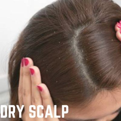 HC-DRY SCALP